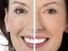 रेविटोनिक्स चेहरे का व्यायाम प्रणाली: कार्रवाई और समीक्षा का सिद्धांत